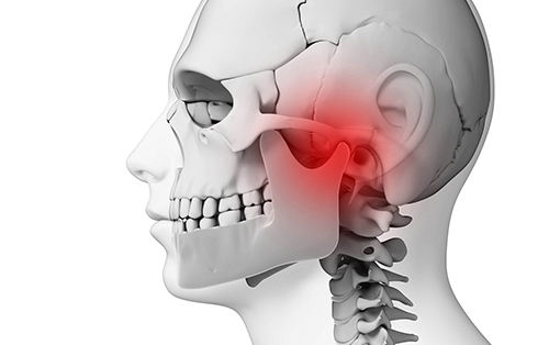 clinica dental acentejo tenerife articulacion temporomandibular ATM craneo