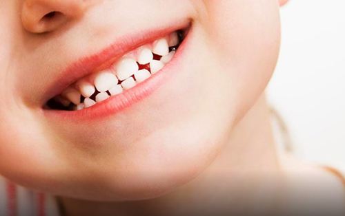 clinica dental acentejo tenerife bruxismo en niños