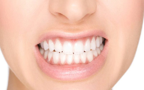 clinica dental acentejo tenerife bruxismo