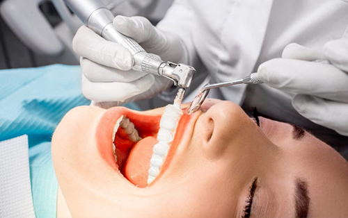 clinica dental acentejo tenerife limpieza dental