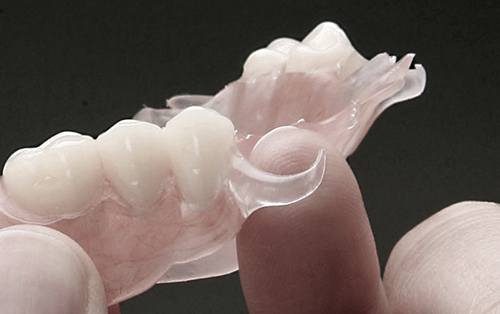 clinica dental acentejo tenerife protesis dental removible con abrazaderas transparentes