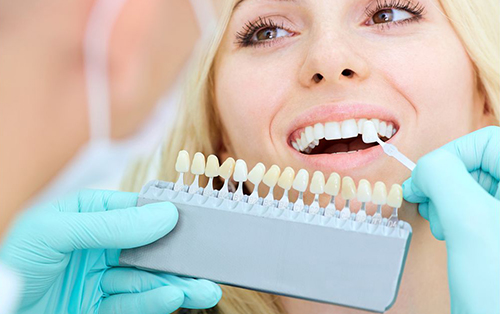 clinica dental acentejo tenerife protesis dentales zirconio color